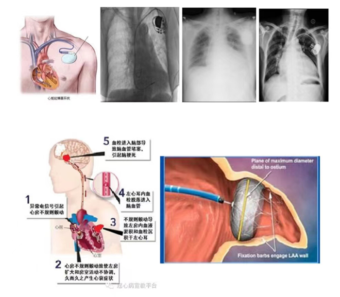 1699348850206780.jpg 微信图片_20231107171015.jpg